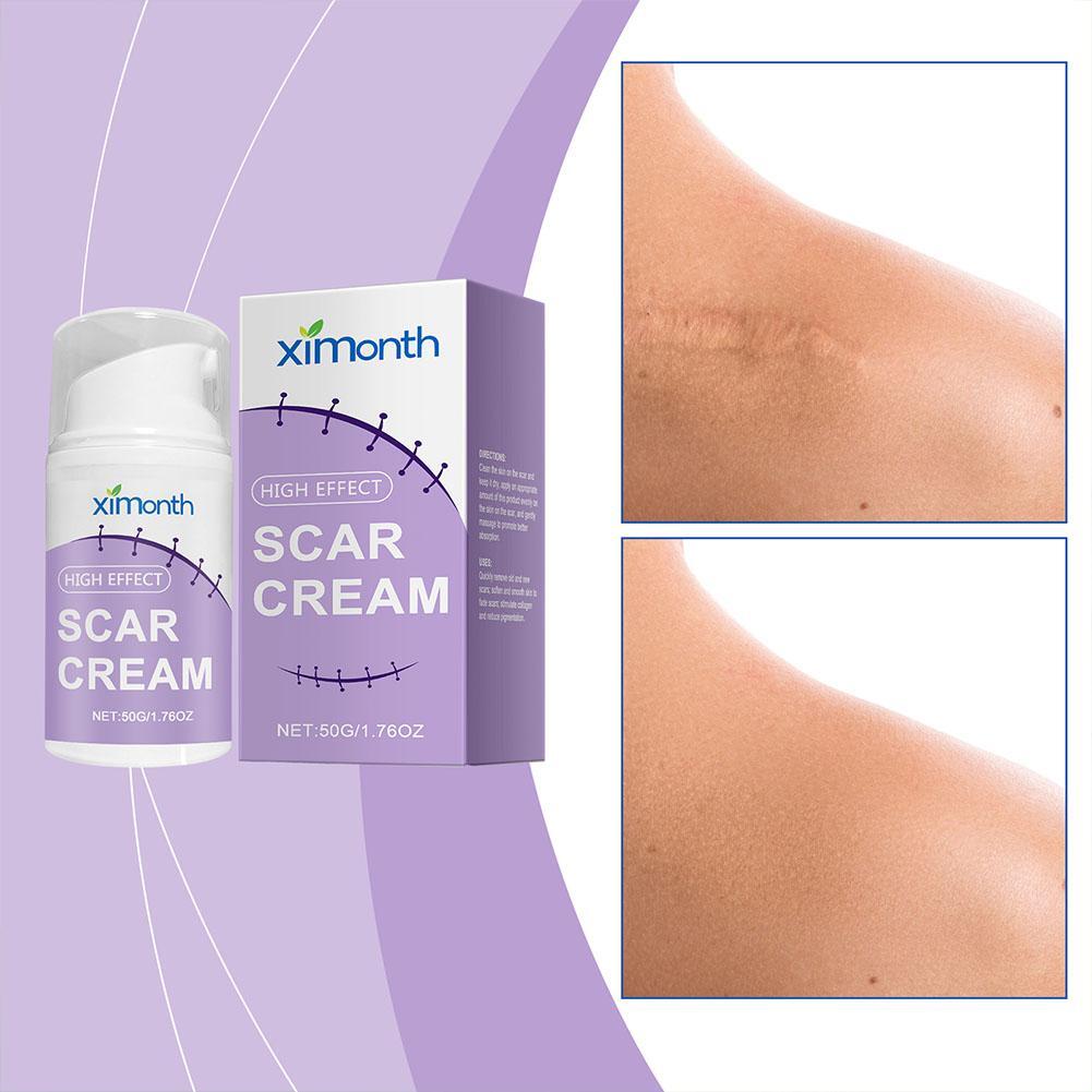 🌿 Ximonth Scar Cream – Creme Redutor de Cicatrizes